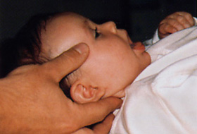 Osteopathischer Griff an einem Baby